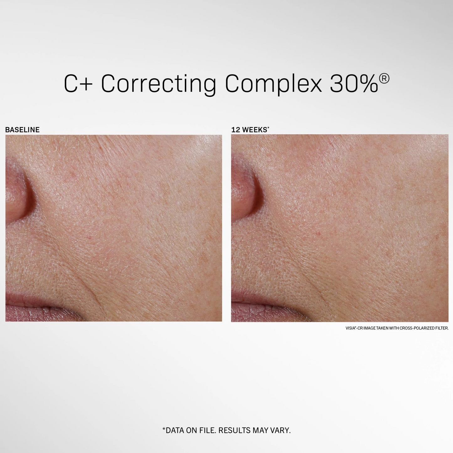 C+ Correcting Complex 30%® | Revision Skincare