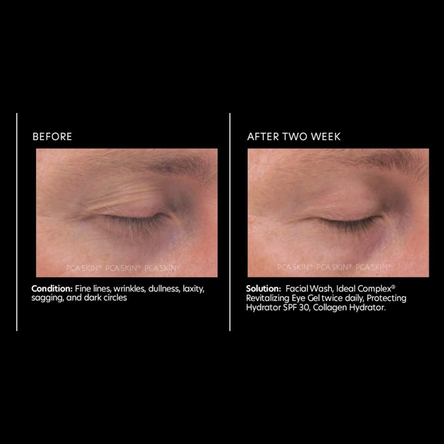 Ideal Complex® Revitalizing Eye Gel | PCA Skin
