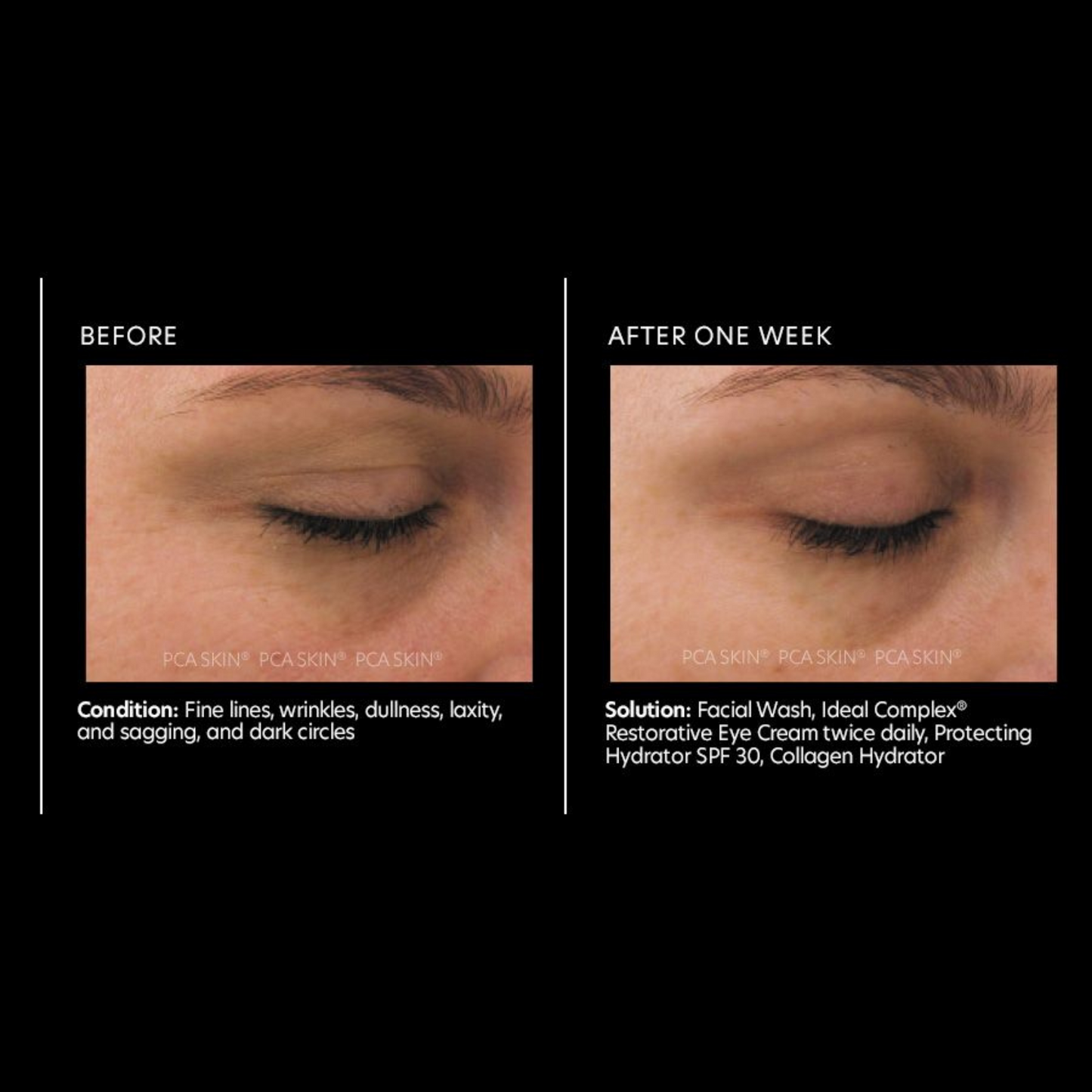 Ideal Complex® Revitalizing Eye Gel | PCA Skin